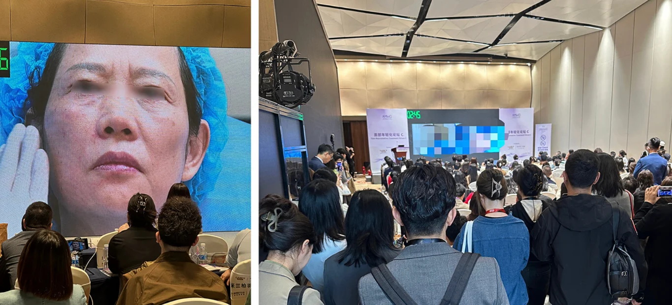 台北醫美推薦 蘋果肌大安區醫美 桃園微整 淚溝 眼袋 黑眼圈 木偶紋 蘋果肌 印地安紋 貓咪紋 嘴邊肉下垂 非手術 無痕拉提 凝境美學診所 曾繁聞醫師 于曉恩醫師 皮膚科 專科 專業 效果自然 微整形 填補 填充 瑞士緹奧希 玻尿酸 喬雅登 水無痕 保柔緹 女神動態 熊貓針 淚溝針 童顏針 伊蓮絲 精靈針 喬雅露 逆時針 價格 副作用 後遺症 dcard ptt 成功案例 下垂 老化 抗老醫美000555