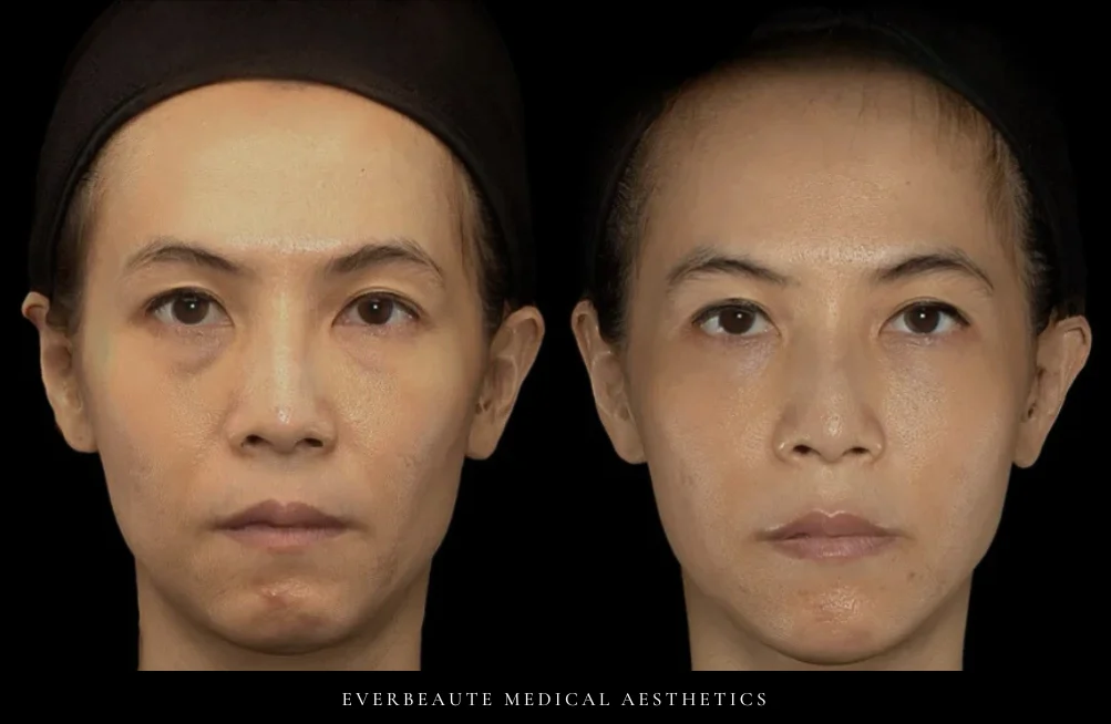 Everbeaute Medical Aesthetics 01