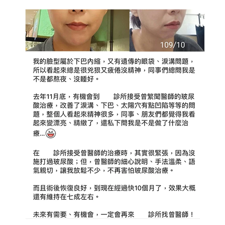 凝境美學診所 口碑評價 好評推薦 于曉恩醫師 曾繁聞醫師 大安區醫美 台北醫美 35