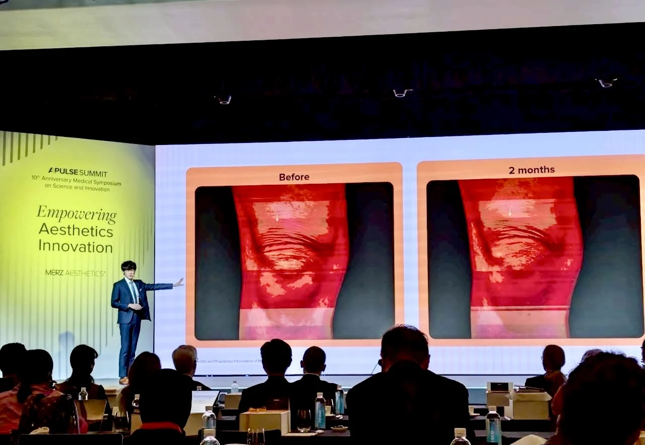 韓國首爾 亞太區醫學美容高峰會 凝境美學曾繁聞院長受邀演講 膝蓋皺紋的治療方式