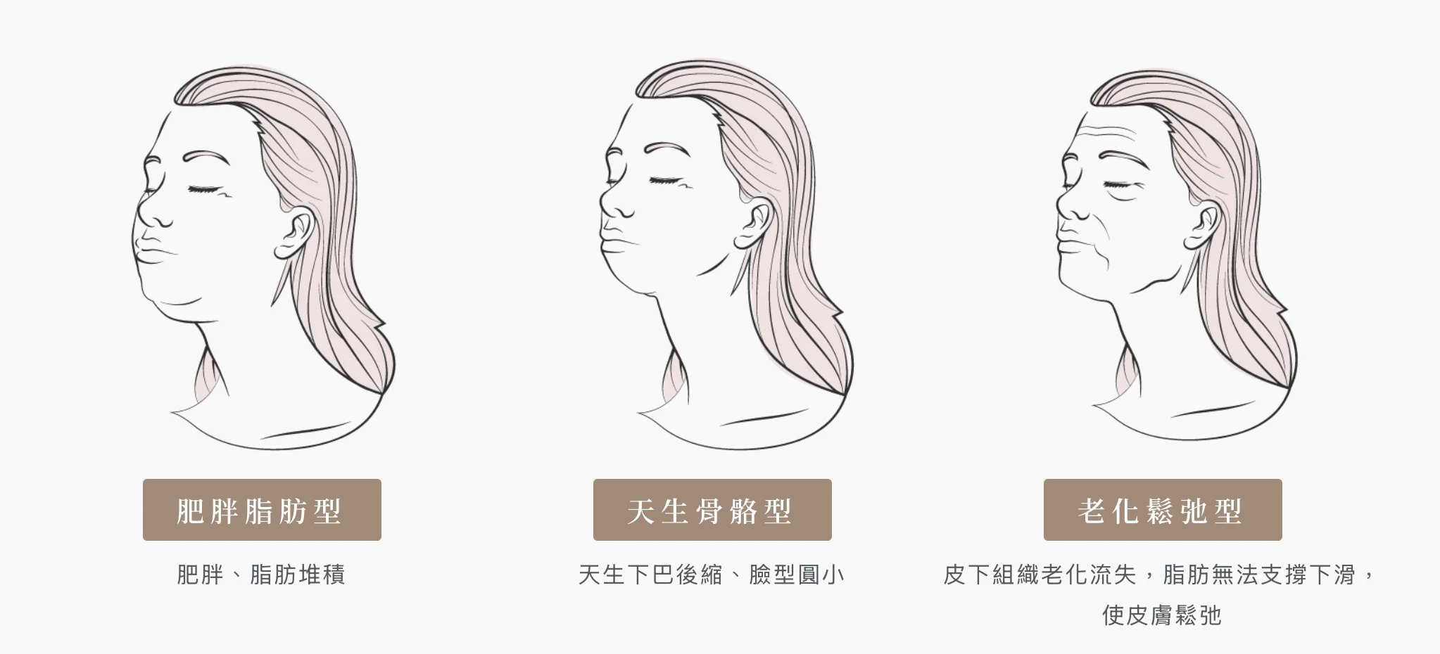 下半臉輪廓模糊，常見與脂肪、結構支撐與緊實度變化有關。